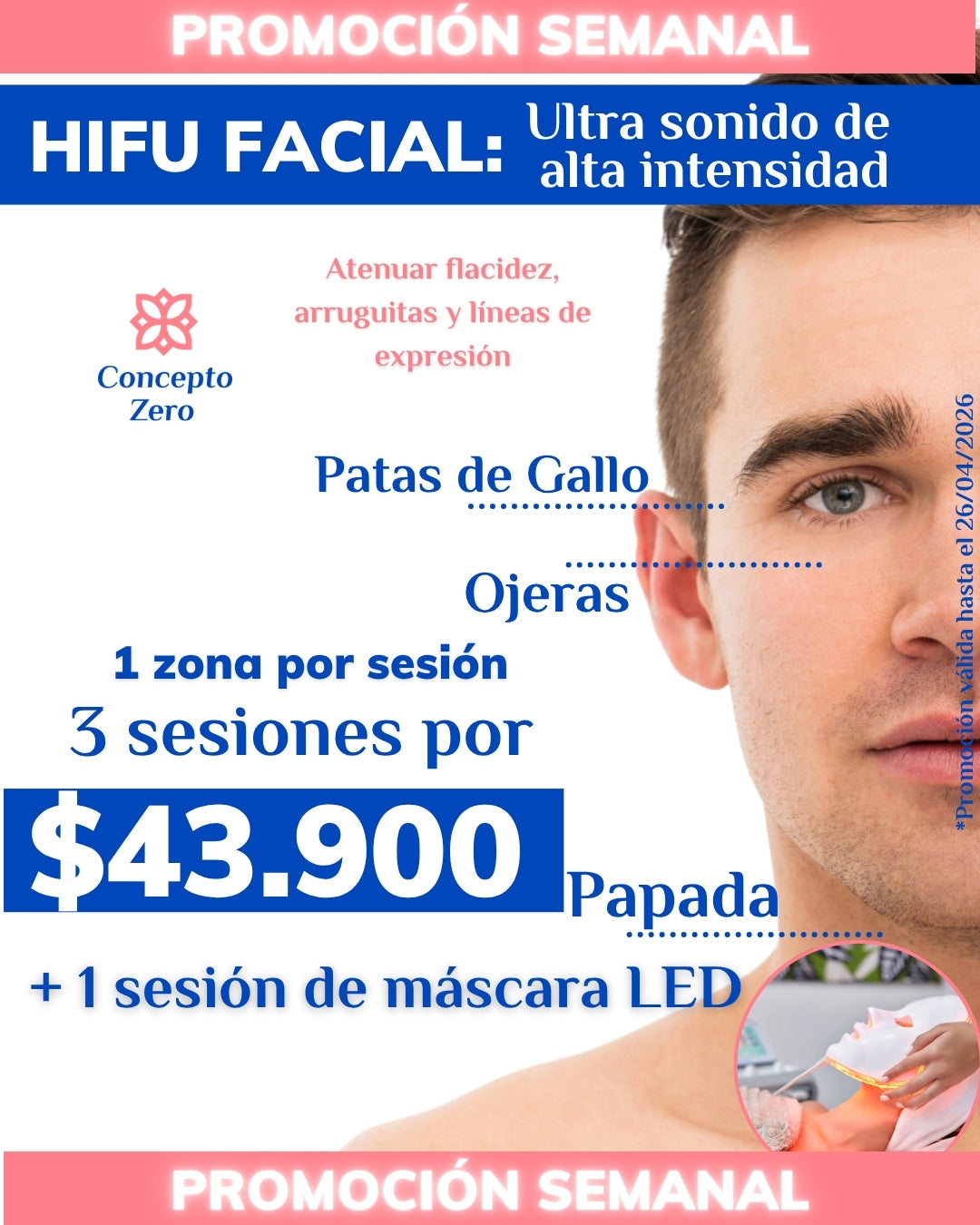 PROMO SEMANAL - HIFU 3 SESIONES ZP + 1 SESIÓN DE MÁSCARA LED DE REGALO