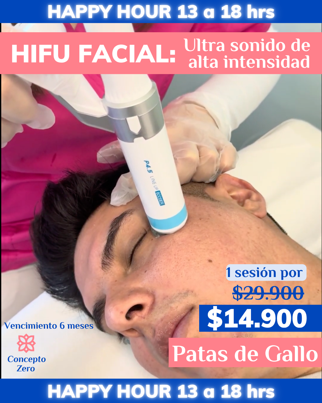 HAPPY HOUR - ZONAS PEQUEÑAS - HIFU 12D