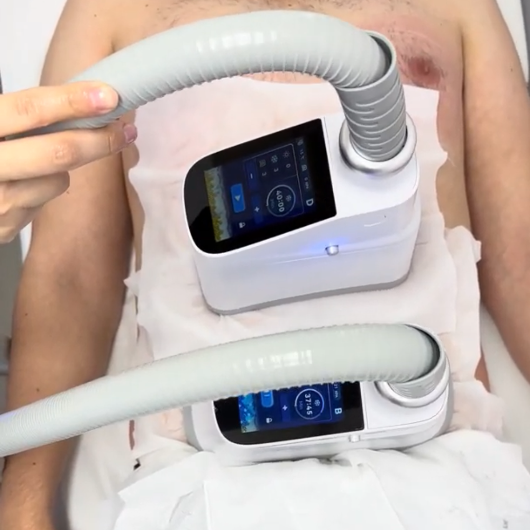 Criolipolisis Abdomen Alto + Bajo
