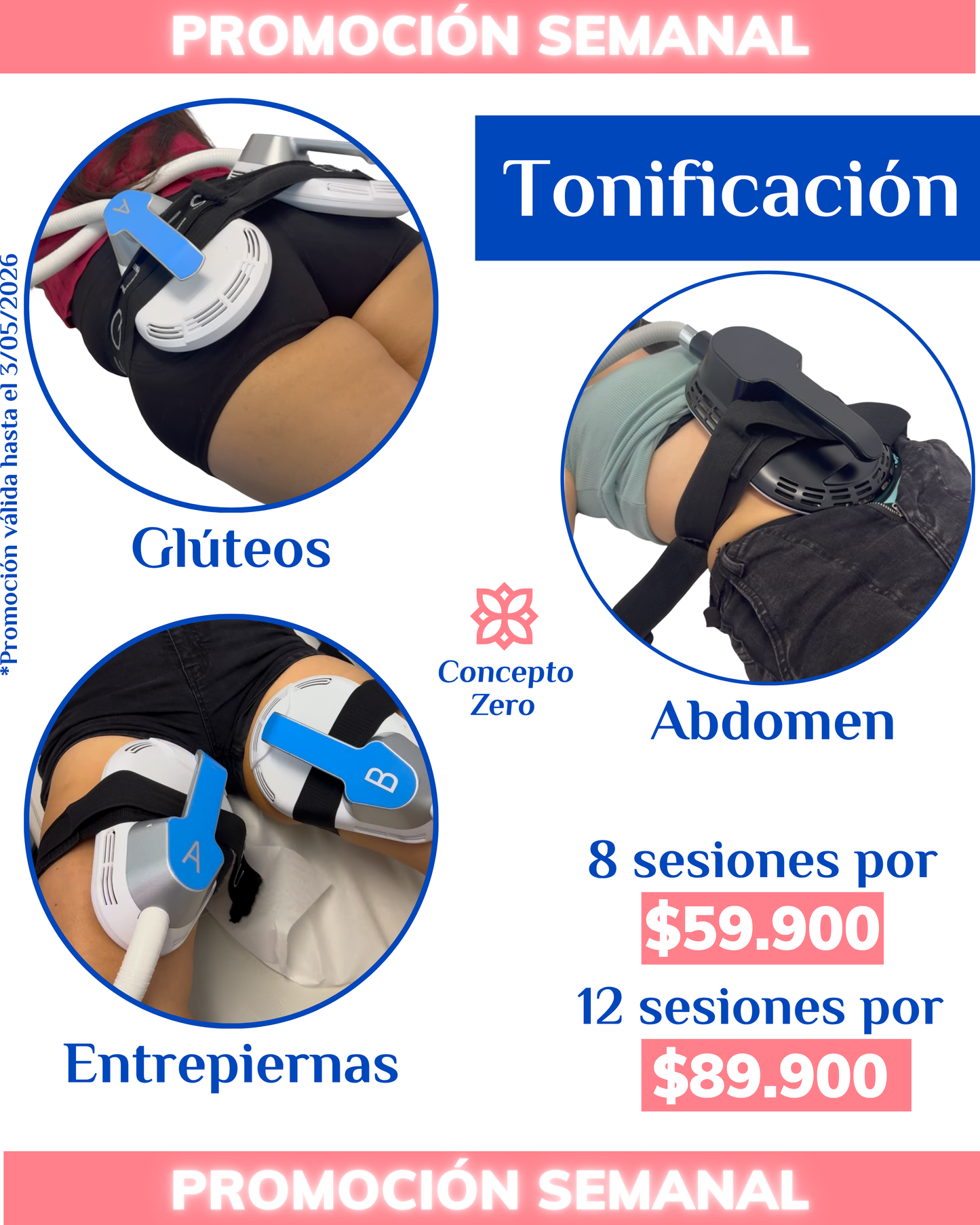 PROMO SEMANAL - TONIFICACIÓN