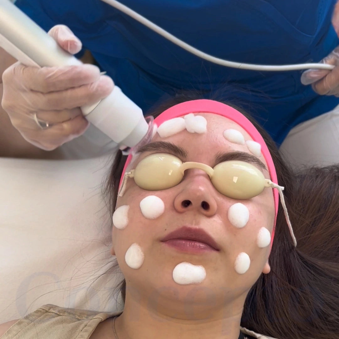 Limpieza Facial Profunda