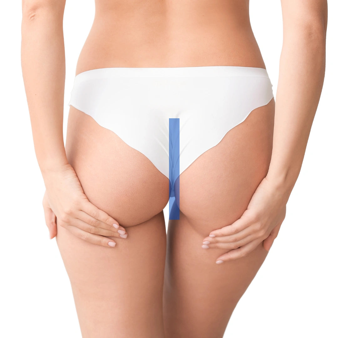 depilacion-laser-providencia