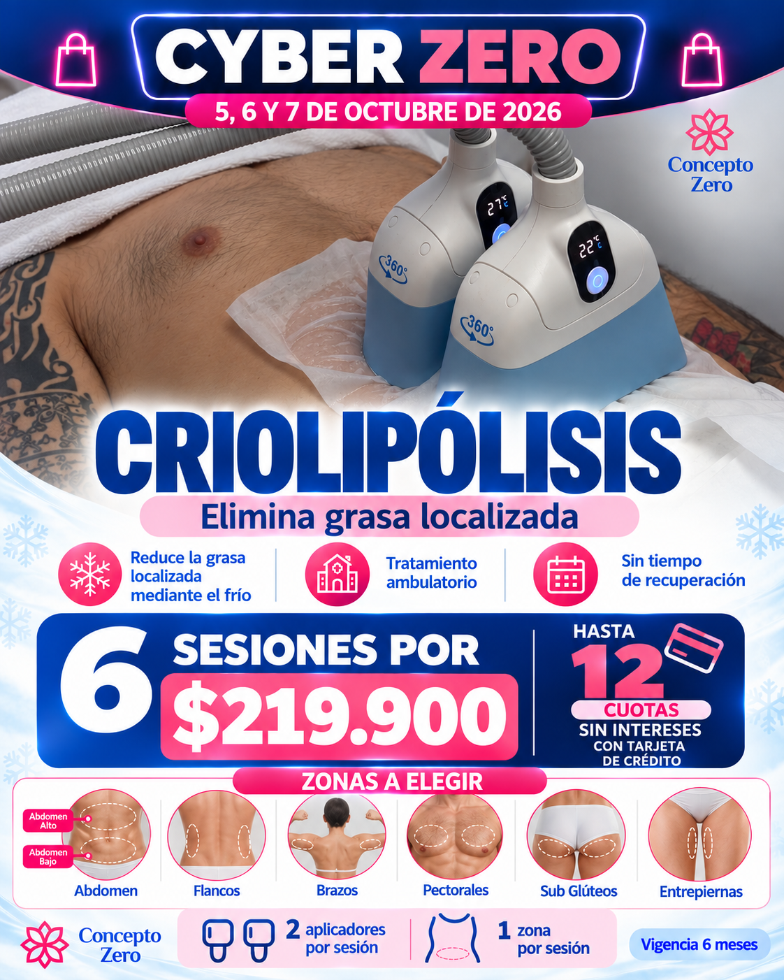 Criolipólisis – Pack 6 Sesiones | Cyber Zero