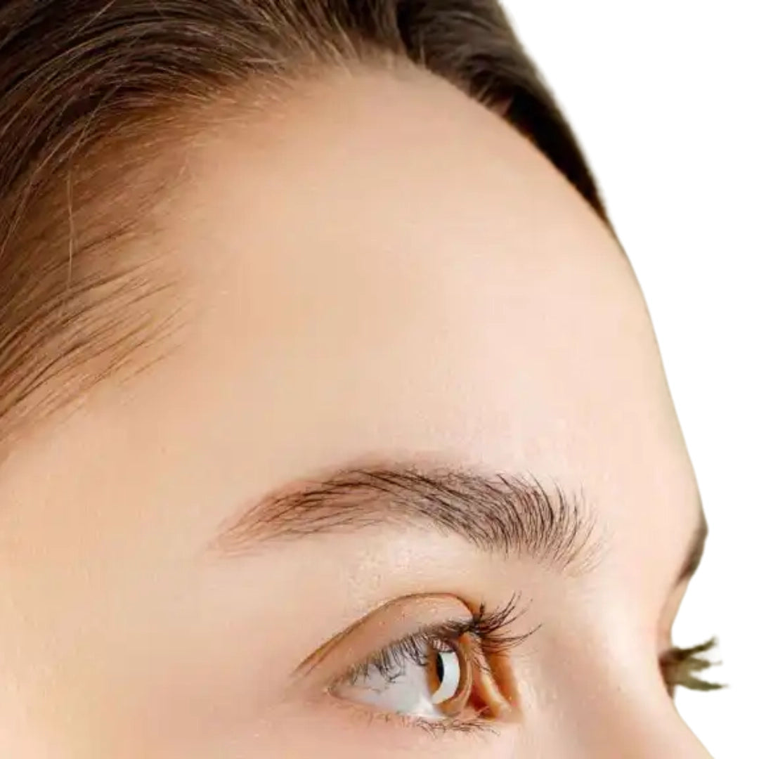 depilacion-laser-frente