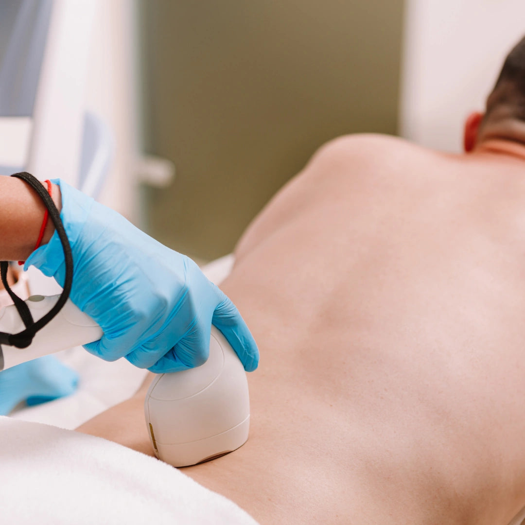 depilacion-masculina-providencia