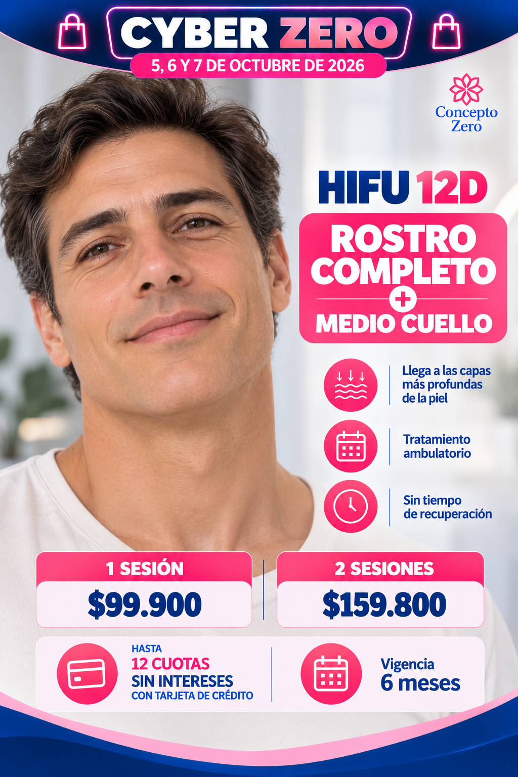 HIFU 12D – Rostro Completo + Medio Cuello | Cyber Zero