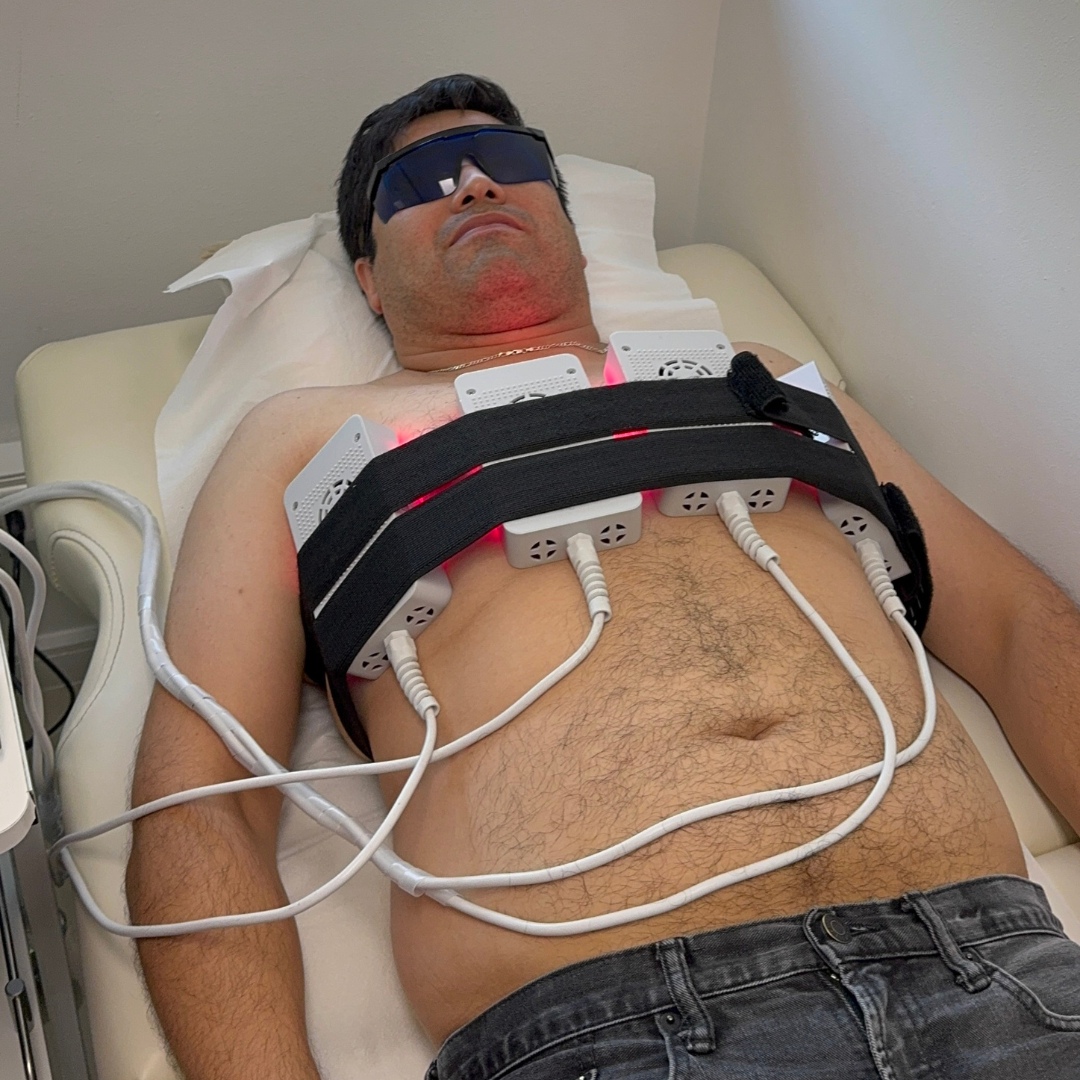 Lipoláser Pectorales