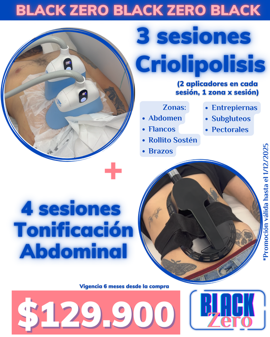 ¡Black Zero! 3 sesiones Criolipolisis + 4 sesiones tonificación