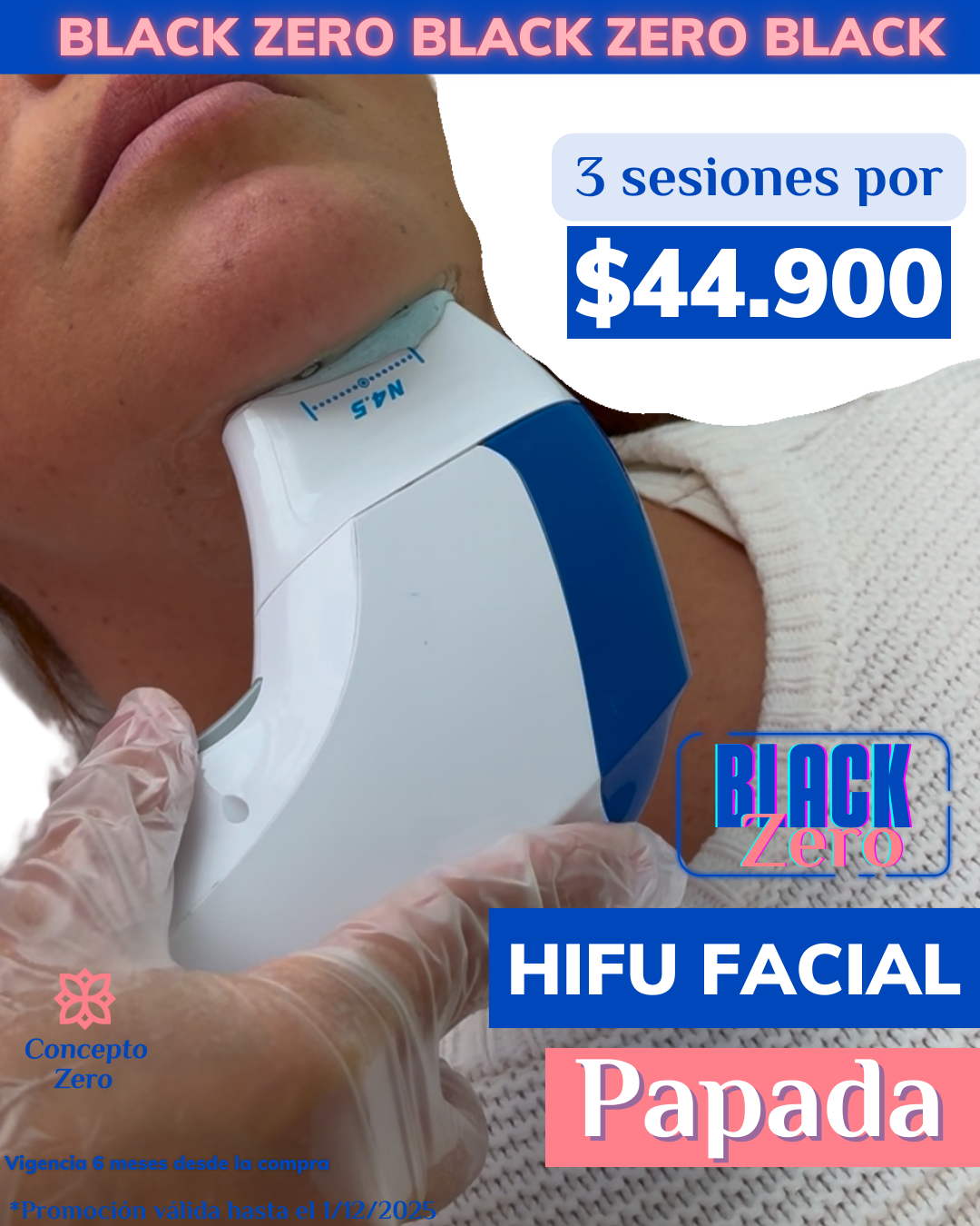 ¡Black Zero! Hifu Papada 3 sesiones