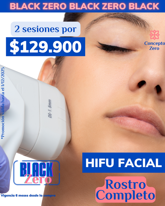 ¡Cyber Zero! Hifu Rostro Completo 2 sesiones