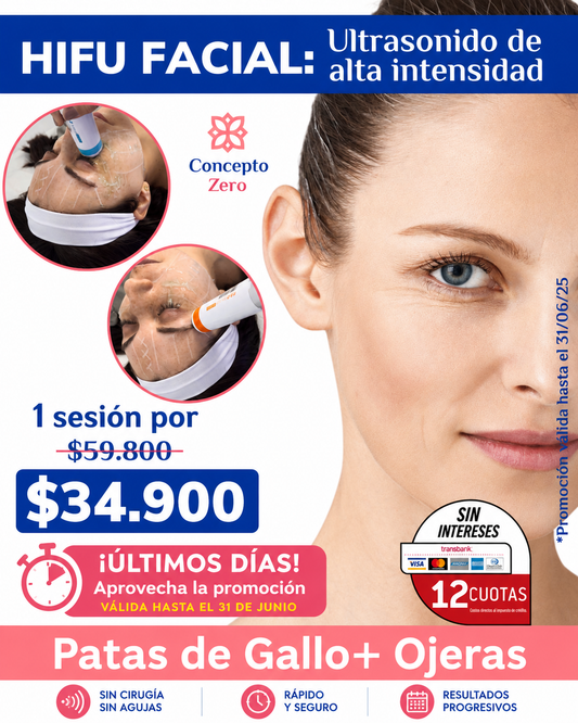 HIFU 12D Patas de Gallo + Ojeras | 1 Sesión $34.900