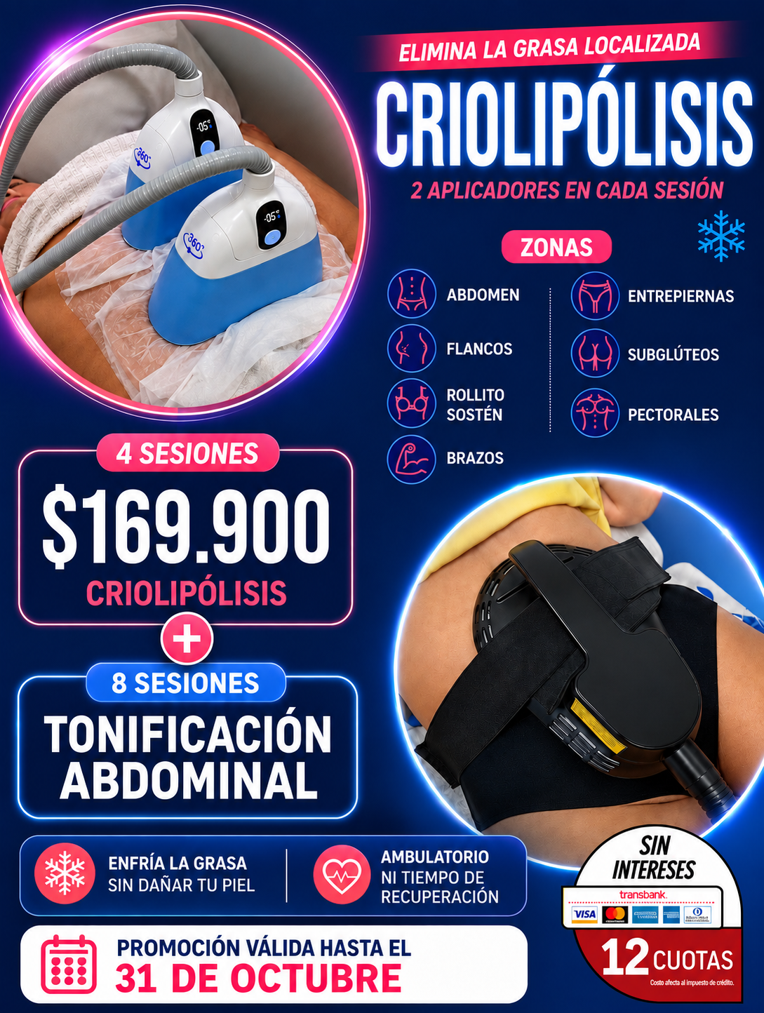4 sesiones de Criolipolisis + 8 sesiones de tonificación
