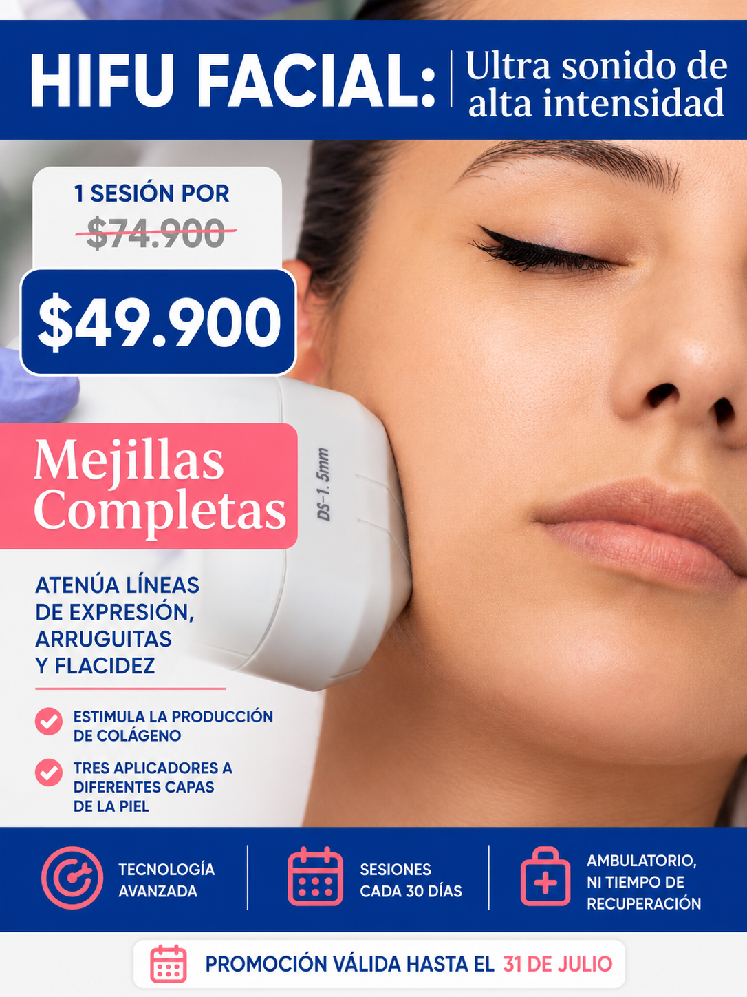 HIFU 12D Mejillas Completas