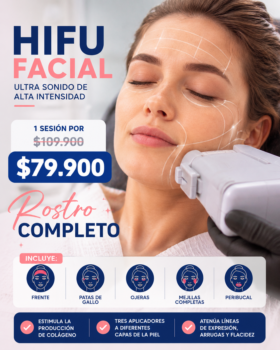 HIFU 12D Rostro Completo - 1 sesión