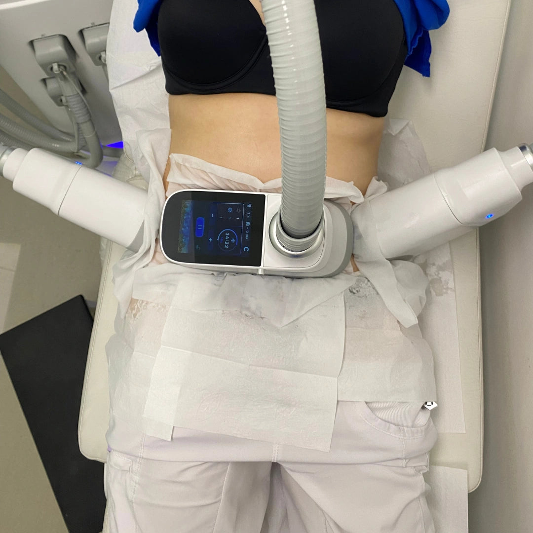 Criolipolisis Abdomen Bajo + Flanco Anterior