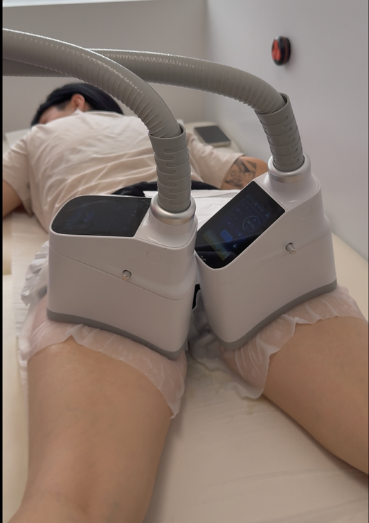 Criolipolisis Subgluteos