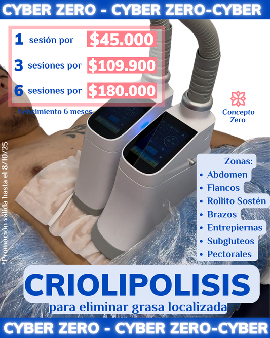 ¡Cyber Zero! Criolipolisis