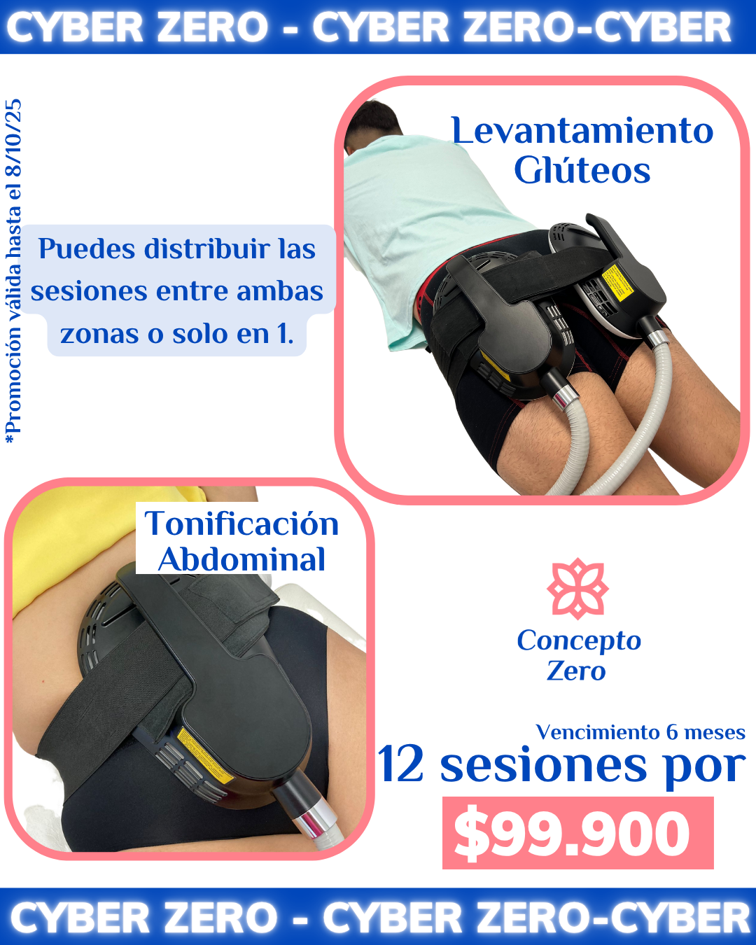 ¡Cyber Zero! Tonificación Abdomen y/o Gluteos