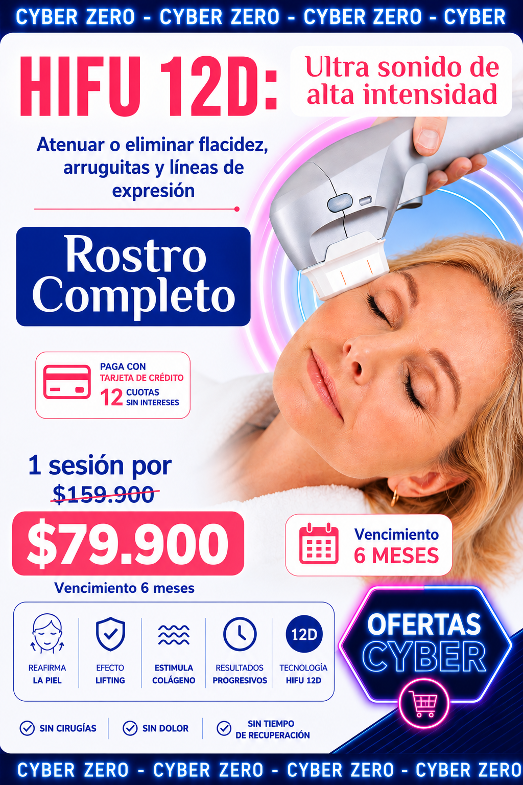 🔥 Cyber Zero | HIFU 12D Rostro Completo 1 Sesión $79.900