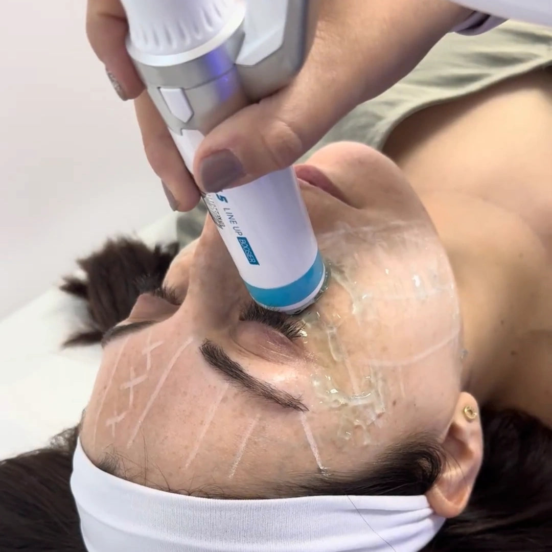 HIFU 12D Ojeras