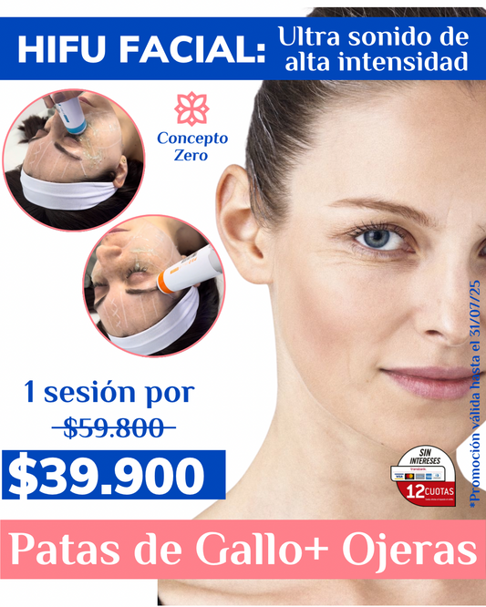 Patas de Gallo + Ojeras - Hifu 12D